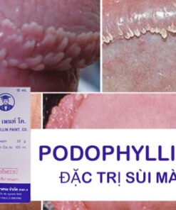 Alternative view of Thuốc Podophyllin 25 Thái Lan chữa trị sùi mào gà tại nhà cho nam nữ