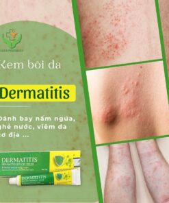 thanh phan Kem boi da tri nam ngua dermatitis thuy sy